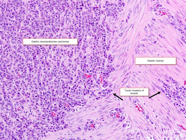 histology slide of stomach tissue